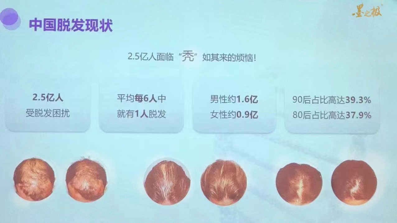 頭皮養(yǎng)護(hù)行業(yè)規(guī)模超1000億